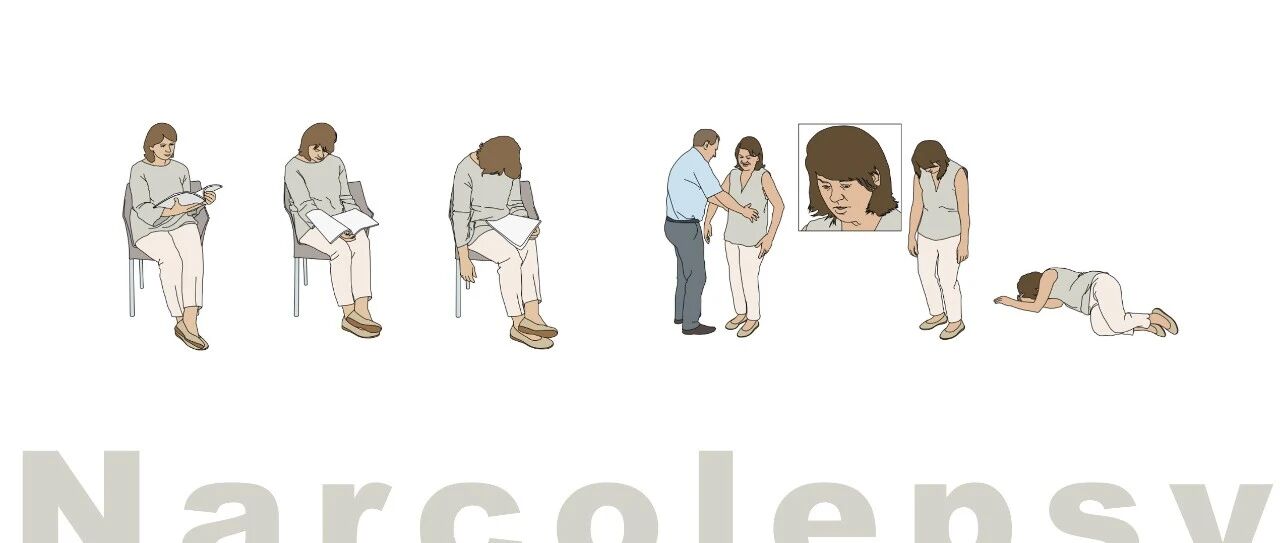发作性睡病Narcolepsy实验室检查一览!