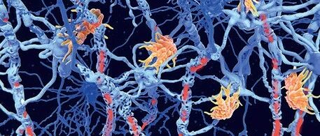 Lancet Neurol | 多发性硬化研究进展与新希望
