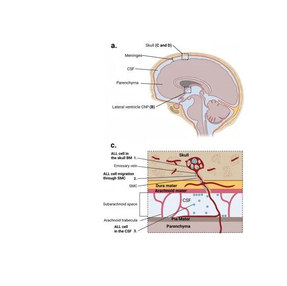 Leukemia丨ALL的中枢神经系统受累：发病机制与靶向治疗