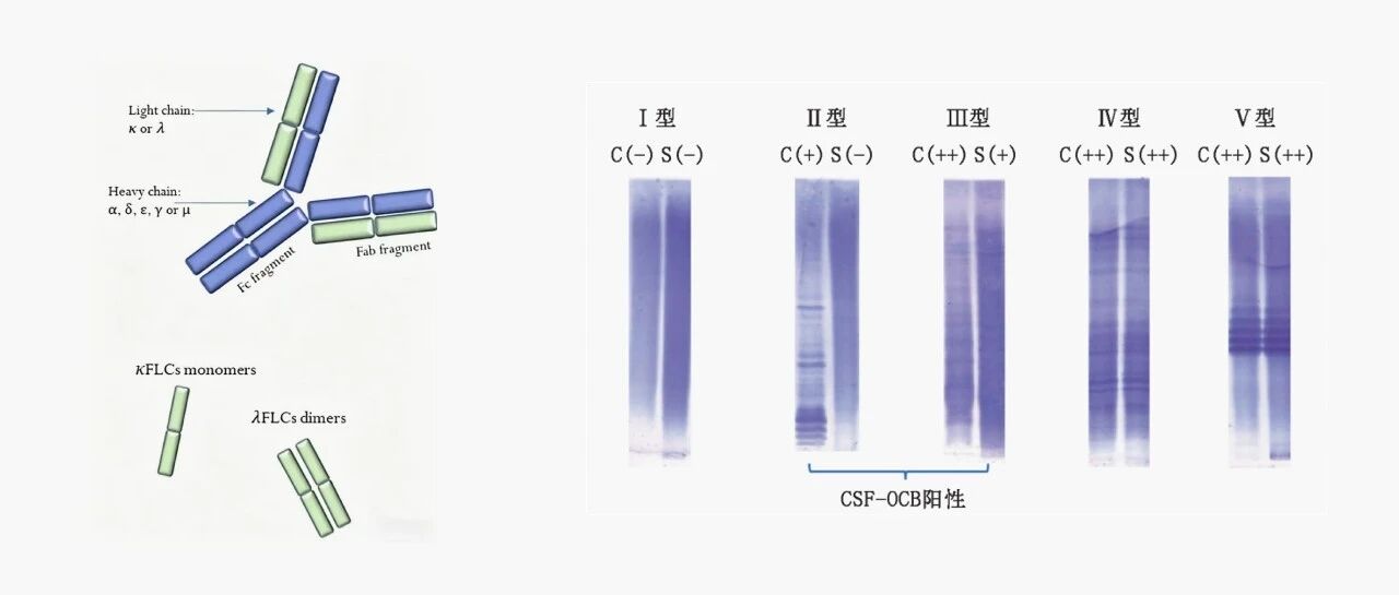 KFLC指数与多标志物联合检测在神经免疫疾病中的诊断价值
